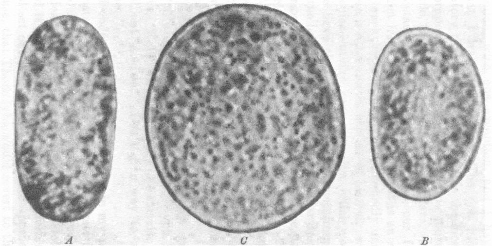 TRANSVERSE SECTIONS OF HUMAN HAIR: A, OF A NEGRO; B, OF AN ENGLISHMAN; C, OF THE BURGLAR. ALL MAGNIFIED 600 DIAMETERS. TRANSVERSE SECTIONS OF HUMAN HAIR: A, OF A NEGRO; B, OF AN ENGLISHMAN; C, OF THE BURGLAR. ALL MAGNIFIED 600 DIAMETERS.