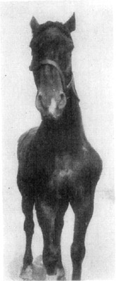 Fig. 7—Paralysis of the suprascapular nerve of the left shoulder Fig. 7—Paralysis of the suprascapular nerve of the left shoulder