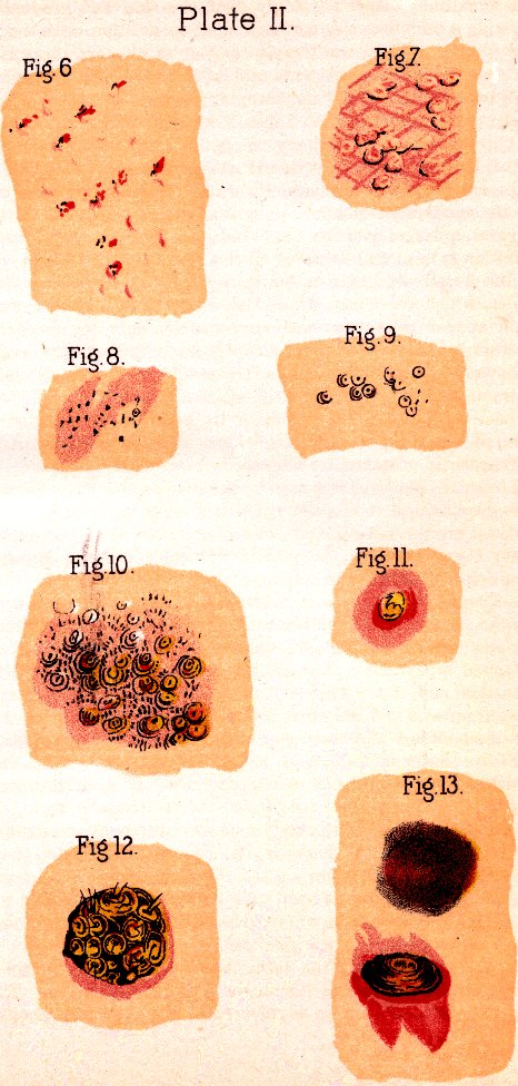 Illustration: Plate II. Fig. 6. Fig. 7. Fig. 8. Fig. 9. Fig. 10. Fig. 11. Fig. 12. Fig. 13.
