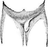 rupture, stage 5 rupture, stage 5