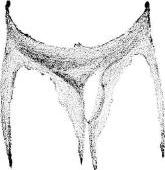 rupture, stage 6 rupture, stage 6