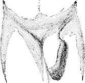 rupture, stage 9 rupture, stage 9