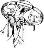 truss described in text truss described in text