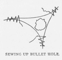SEWING UP BULLET HOLE.