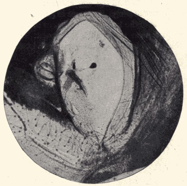 The auditory organ of a locust. The auditory organ of a locust.