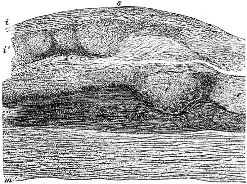 see caption see caption